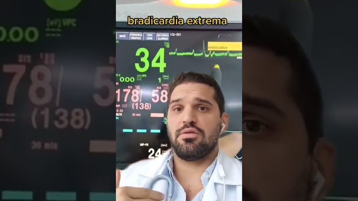 Vigilar frecuencia, ritmo, profundidad y esfuerzo de las respiraciones